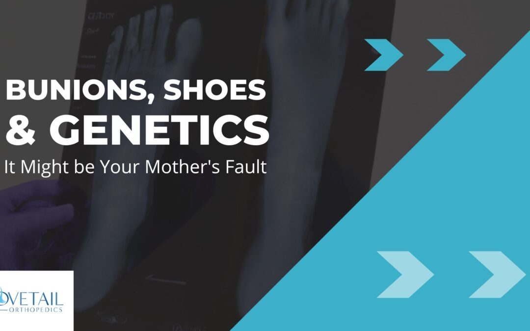 Bunions, Shoes & Genetics: It Might be Your Mother’s Fault