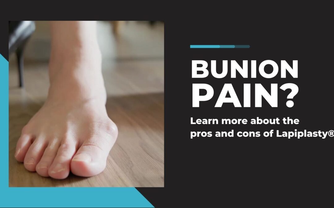 Lapiplasty® Bunion Surgery Pros and Cons