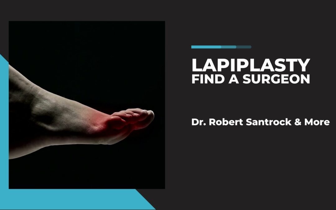An image with a dark background featuring a close-up view of a foot and ankle from a side perspective. The foot appears to have some redness at the forefront. On the right side of the image, there's text that reads 'LAPIPLASTY FIND A SURGEON' in bold, white letters. Below this main title, there's additional text that mentions 'Dr. Robert Santrock & More'.