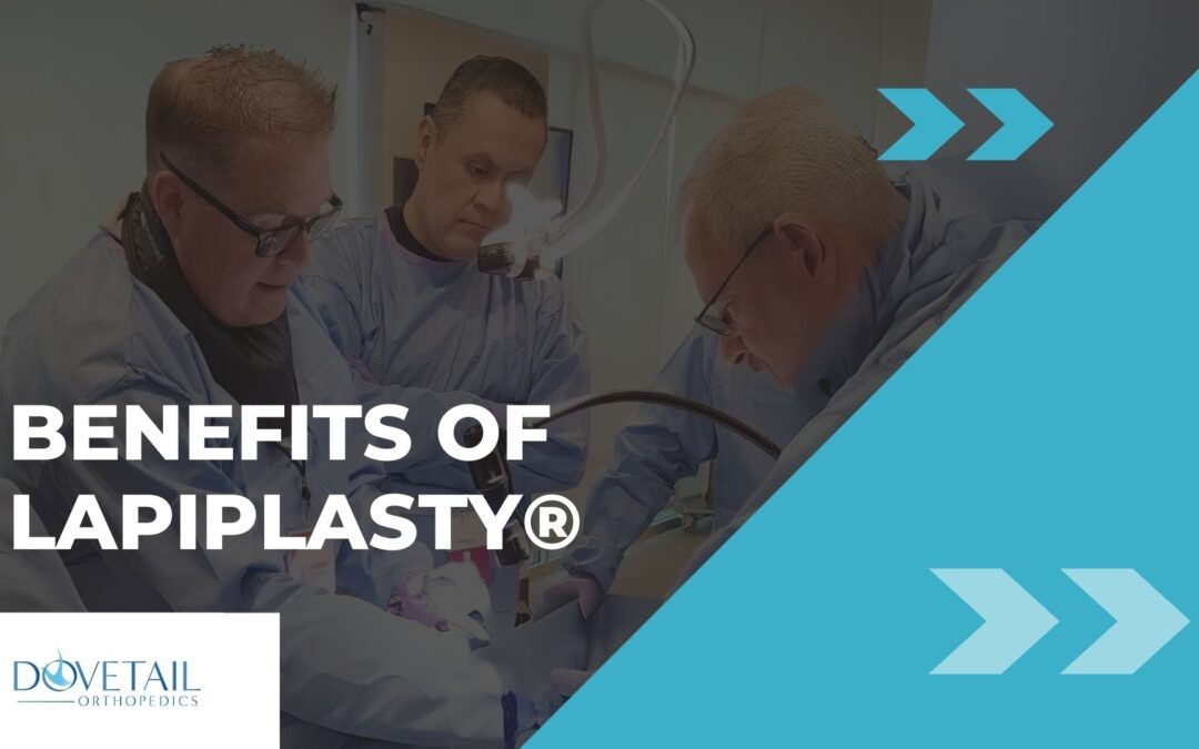 Benefits of Lapiplasty graphic with text, Benefits of Lapiplasty and Dovetail logo