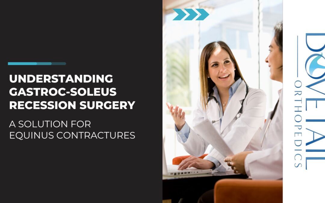 Promotional graphic for Dovetail Orthopedics featuring the title 'Understanding Gastroc-Soleus Recession Surgery' with a subtitle 'A Solution for Equinus Contractures'. On the right, two medical professionals are engaged in conversation, one is explaining something to the other who is attentively listening. The Dovetail Orthopedics logo is prominently displayed on the right side of the image.