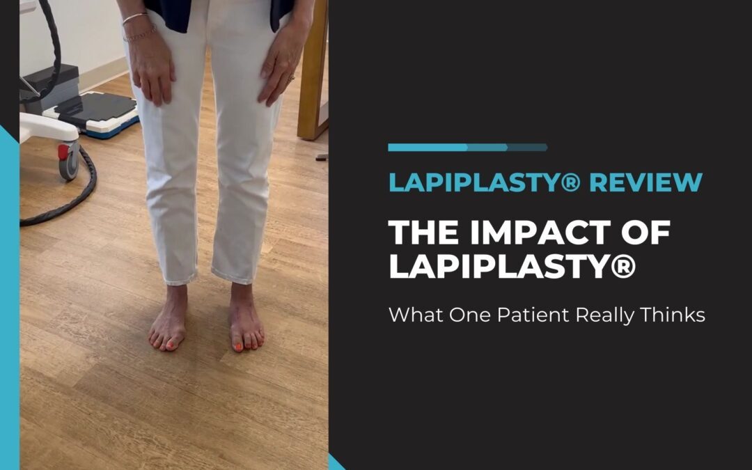 An image showing the lower half of a person standing, focusing on their bare feet with slightly curled toes. They are wearing white trousers. To the left is a snippet of medical equipment and to the right is a large text overlay that reads Lapiplasty® Reviews - THE IMPACT OF LAPIPLASTY® - What One Patient Really Thinks. The background is a room with wooden flooring.