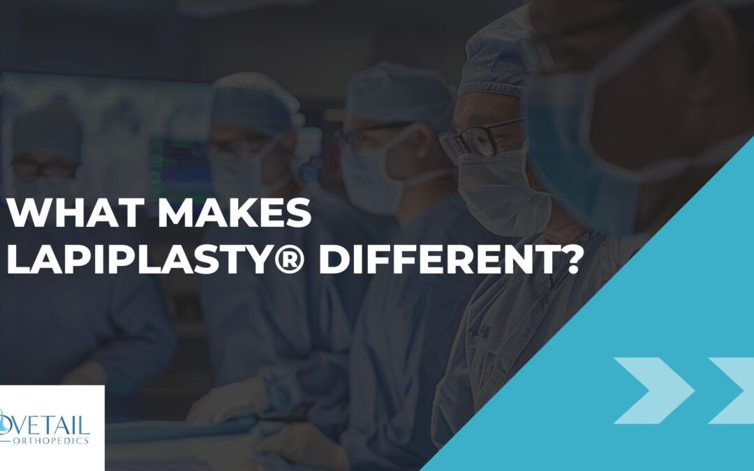 The image is a promotional graphic featuring the text "WHAT MAKES LAPIPLASTY® DIFFERENT?" prominently in the center against a background of blurred surgeons in an operating room. The Lapiplasty® trademark is clearly visible, indicating a specific brand or type of surgical procedure or product. The design includes a logo for "Dovetail Orthopedics" in the bottom left corner and a visual element of two chevrons pointing right, suggesting forward motion or progress. The color scheme features a blend of blue tones, aligning with the medical theme. This graphic is likely used for educational or marketing purposes, highlighting the unique qualities of the Lapiplasty® procedure within the field of orthopedics.