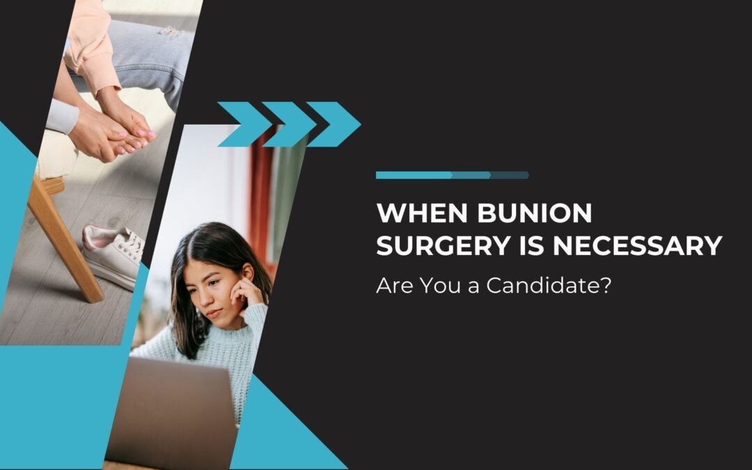 When Bunion Surgery is Necessary: Are You a Candidate?