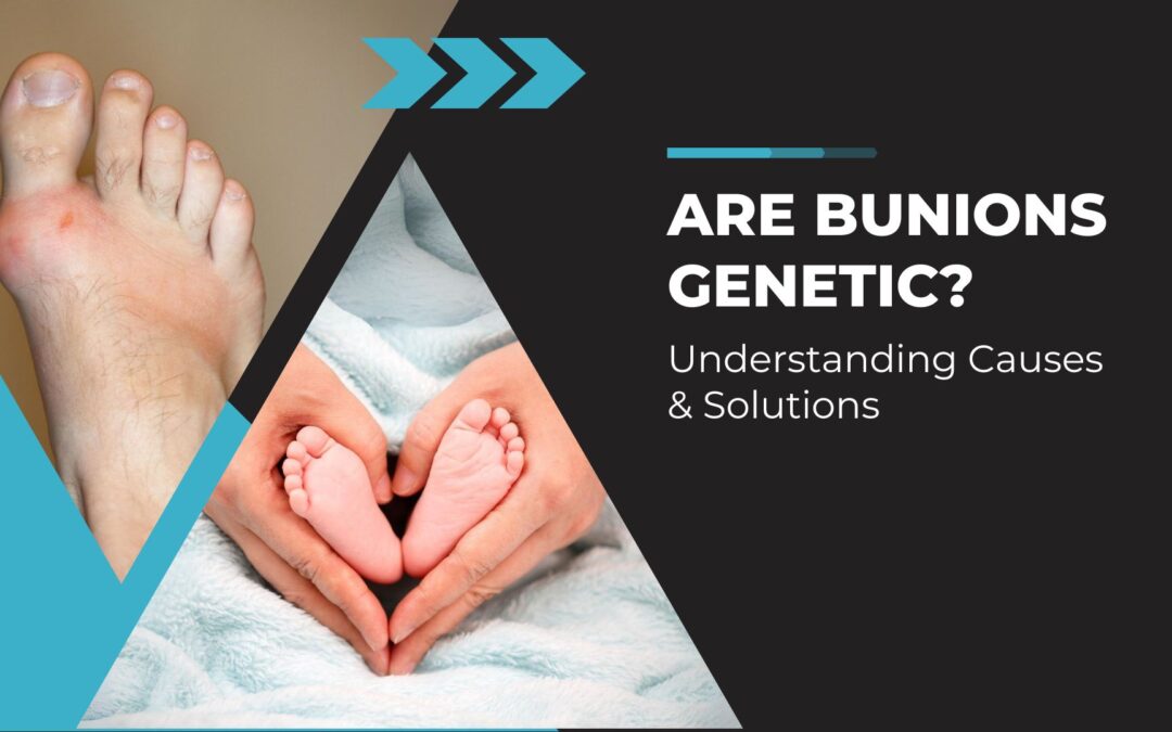 Are Bunions Genetic? Understanding Causes & Solutions